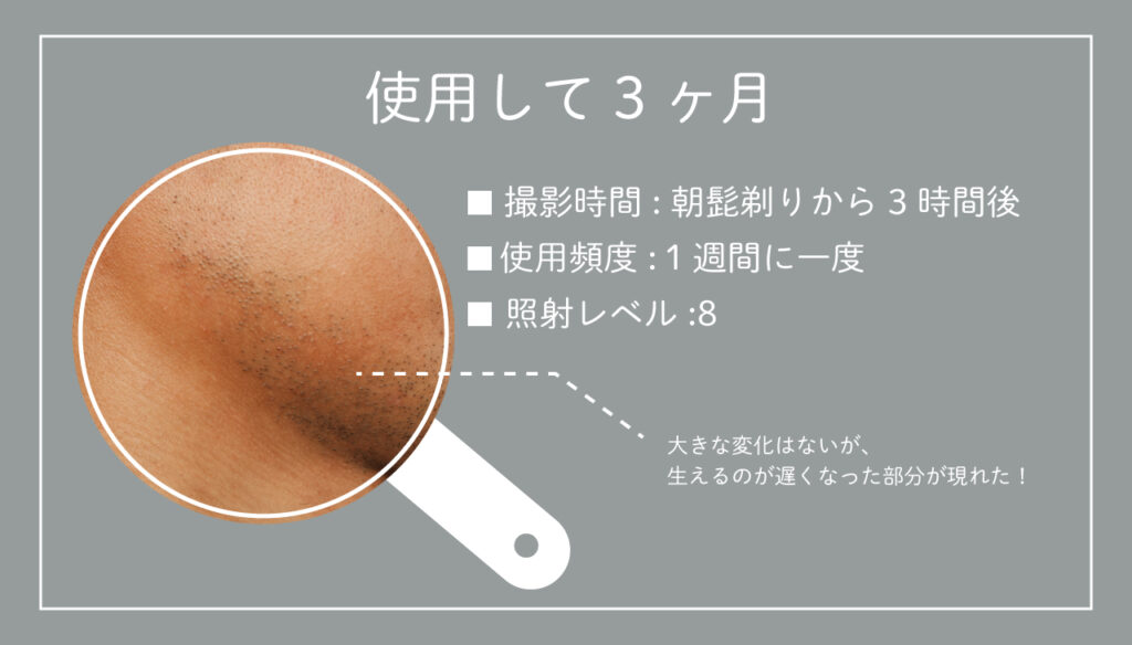 KE-NON体験談