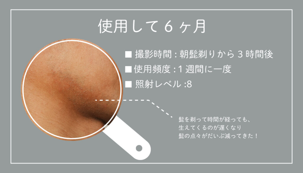 KE-NON体験談